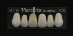 Figure 12  Individualized characterization on the Veracia composite teeth.