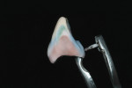 Figure 13  With the restoration removed from the model, a darker dentin shade is added at the gingival one-third to create a more natural appearance.