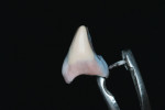 Figure 14  Opal Translucent will be added to the incisal edge down to the gingival one-third to allow for light transmission through the interproximal surfaces.