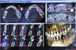 Figure 7  Planmeca showcases its Romexis software, a comprehensive program for acquiring, viewing, and processing 2-D and 3-D images for implant treatment planning.