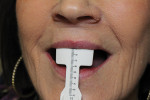 Figure 3  The papillameter also measures high lip line with the patient in full smile, which enables the technician to determine the percentage of tooth that shows at full smile.