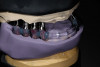 Figure 6  Maxillary right implant-supported restoration exhibiting purulence upon palpation. Bleeding on light probing and 10 mm probing depth was also present.