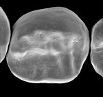Figure 3B  IPS e.maxCAD fabricated by dentists chairside using a new fast-mill/fast-fire protocol developed by Dr. Paul Child.