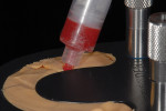 Figure 6  An injection process was used throughout this entire restorative process.