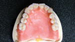 Figure 16  Natural arrangement of the maxillary anterior dentition.
