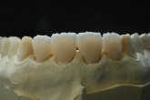 Dental Implant Maintenance Webinar Thumbnail