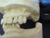 (13.) The patient’s rest position photograph showed nearly the correct amount of tooth display.