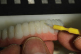 Demystifying The Guided Implant Surgery Process: From Plan to Final Restorations Webinar Thumbnail
