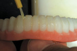 Figure 30  The corner areas ofthe denture teeth were paintedwhite to create a three-dimensionaleffect.