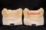 Figure 4  The orthodontic wax-up helps visualize the possibilities available when repositioning is an integral part of obtaining optimal results on a given case.