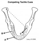 Figure 3  Working and nonworking side occlusal interferences create competing tactile sensory information.