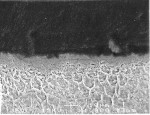 Figure 5A  The SEM of the hybrid layer or resin-dentin interdiffusionzone shows polymerized resin intermingled with collagen fibers. This viewdemonstrates good formation of the hybrid layer in dentin(courtesy of Dr. Trajtenberg).