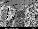 Figure 7  The SEM view demonstrates the particulate debris of thesmear layer. Note the composition of saliva, blood, micro-organisms,ground enamel, and dentin (courtesy of Dr. Perdigão).