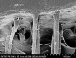 Figure 10  This SEM shows the simultaneous infiltration of the collagenfibers while decalcifying the inorganic component to the same depth indentin (courtesy of Dr. Perdigão).