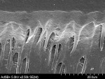 Figure 11  The SEM reveals a restorative material properly bonded toenamel and dentin that provides the potential for long-term functional successof a tooth and restoration (courtesy of Dr. Perdigão).