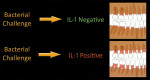 Figure 2  Genetic susceptibility to IL-1 production.