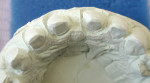 Figure 23  View of the cast of the prepared teeth.