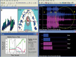 Figure 2a  Pretreatment left excursion computerized occlusal analysis/EMG recording frames. Intercuspal position before excursion.