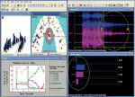 Figure 2b  Pretreatment left excursion computerized occlusal analysis/EMG recording frames. Early left excursion.