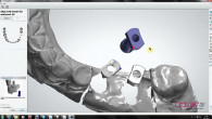 Peri-Implantitis: Current Concepts for Diagnosis and Treatment Webinar Thumbnail