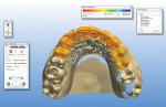 Figure 11 A 3D proposal of the final restorations.