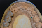 Figure 16 An occlusal view of the final restoration.