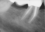 Figure 7  6-month check-up radiograph.