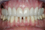Figure 21  Final postoperative photographs demonstrate successful esthetic results.