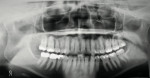 Figure 4  Panoramic radiograph showing generally healthy bone levels.