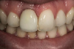 Figure 1  Mouth checked during hydration stage.