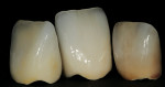 Figure 7  Samples demonstrating diverse aspects of internal color modifications.