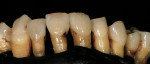 Figure 20  Natural, extracted teeth can be used for tooth study.