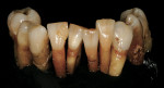 Figure 21  Natural, extracted teeth can be used for tooth study.