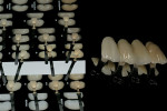 Figure 23  Dentin shade tabs have improved through research and development.