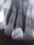 Figure 8  Radicular and periodontal integrity 7 years after treatment.