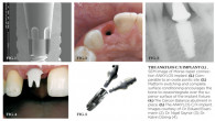 Managing Dental Conditions of the Baby Boomer Generation Webinar Thumbnail