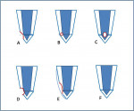 Figure 1 Common reattachment techniques for uncomplicated fractures as described by Reis, 2004: (A) enamel beveling; (B) V-shaped internal enamel groove; (C) internal dentin groove; (D) external chamfer; (E) overcontour; and (F) simple reattachment.