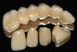 Figure 6 The completed Cercon ht restorations before delivery to the dentist.