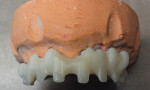 Figure 5 Secondary structure, occlusal view.