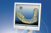 Better, More Predictable Implant Surgery: Let Your Technology Do the Hard Work! Webinar Thumbnail