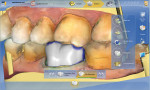 Figure 8 Images taken from the buccal area.