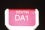 The dentin build-up will complete the dentin structure predominantly from the middle to incisal third.