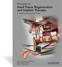 Principles of Hard Tissue Regeneration and Implant Therapy—A Complete Step-by-Step Guide by AEGIS Dental Network