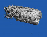Figure 17  Micro CT analysis of the retrieved bone shows dense bone throughout the length of the core.