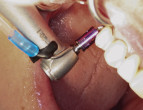 A Tooth's Best Friend: The Dental Hygienist Webinar Thumbnail