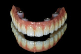 Transforming Restorative Dentistry with Artificial Intelligence Webinar Thumbnail