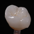 Eliminating Variables for Successful Denture Outcomes Webinar Thumbnail