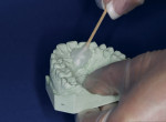 Figure 4  A sheet of the Triad material tried on the maxillary cast to verify that the size of the material will be adequate.
