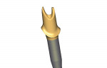 Figure 2. An implant abutment is digitally designed in multiple steps.