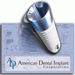 Implants by American Dental Implant Corporation